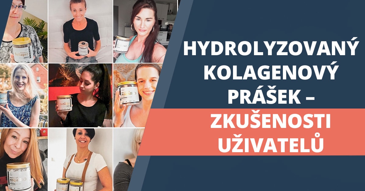 CZ_Collagen_Mnenja