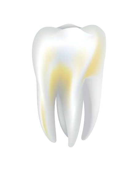 Zubní kámen